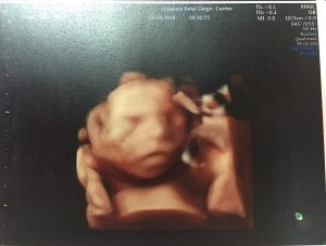 Baby Kyriakidou 20 Weeks 3D