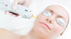 Laser Treatment