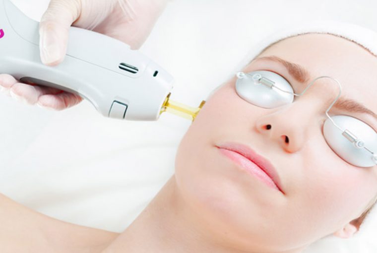 Laser Treatment